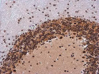 Anti-IRS1 (phospho Ser307) antibody used in IHC (Paraffin sections) (IHC-P). GTX133848