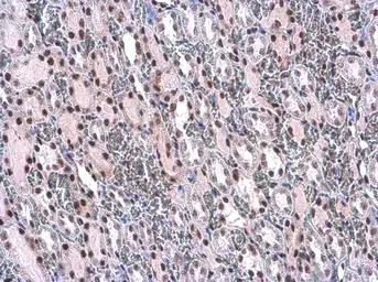 Anti-IRS1 (phospho Ser307) antibody used in IHC (Paraffin sections) (IHC-P). GTX133848