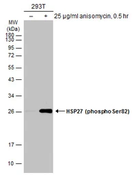 Anti-HSP27 (phospho Ser82) antibody used in Western Blot (WB). GTX133850