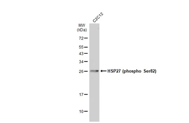 Anti-HSP27 (phospho Ser82) antibody used in Western Blot (WB). GTX133850