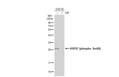 Anti-HSP27 (phospho Ser82) antibody used in Western Blot (WB). GTX133850