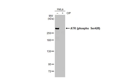 Anti-ATR (phospho Ser428) antibody used in Western Blot (WB). GTX133852