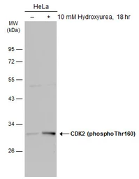 Anti-CDK2 (phospho Thr160) antibody used in Western Blot (WB). GTX133862