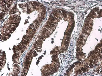 Anti-CDK2 (phospho Thr160) antibody used in IHC (Paraffin sections) (IHC-P). GTX133862