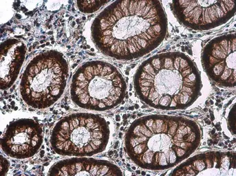 Anti-CDK2 (phospho Thr160) antibody used in IHC (Paraffin sections) (IHC-P). GTX133862
