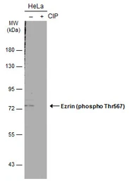 Anti-Ezrin (phospho Thr567) antibody used in Western Blot (WB). GTX133868