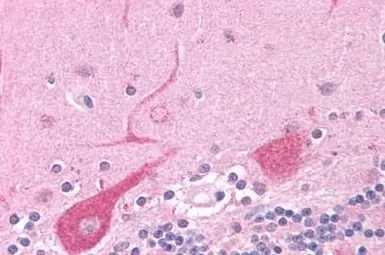 Anti-NEK6 antibody used in IHC (Paraffin sections) (IHC-P). GTX13387