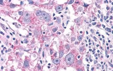 Anti-NEK6 antibody used in IHC (Paraffin sections) (IHC-P). GTX13387