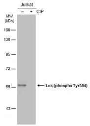 Anti-Lck (phospho Tyr394) antibody used in Western Blot (WB). GTX133876