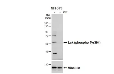 Anti-Lck (phospho Tyr394) antibody used in Western Blot (WB). GTX133876