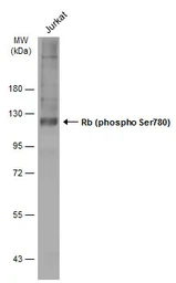 Anti-Rb (phospho Ser780) antibody used in Western Blot (WB). GTX133893