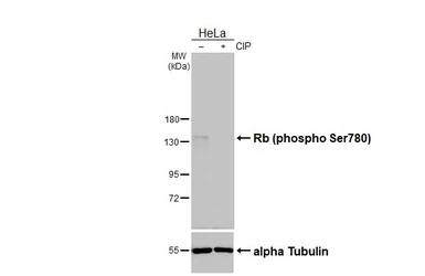 Anti-Rb (phospho Ser780) antibody used in Western Blot (WB). GTX133893