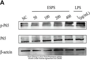 Anti-NFkB p65 (phospho Ser536) antibody used in Western Blot (WB). GTX133899