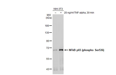 Anti-NFkB p65 (phospho Ser536) antibody used in Western Blot (WB). GTX133899