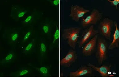 Anti-NFkB p65 (phospho Ser536) antibody used in Immunocytochemistry/ Immunofluorescence (ICC/IF). GTX133899