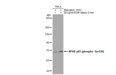 Anti-NFkB p65 (phospho Ser536) antibody used in Western Blot (WB). GTX133899
