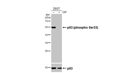 Anti-p53 (phospho Ser33) antibody used in Western Blot (WB). GTX133902