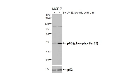 Anti-p53 (phospho Ser33) antibody used in Western Blot (WB). GTX133902