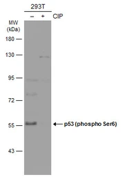 Anti-p53 (phospho Ser6) antibody used in Western Blot (WB). GTX133905