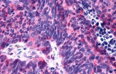 Anti-P2Y6 antibody used in IHC (Paraffin sections) (IHC-P). GTX13391