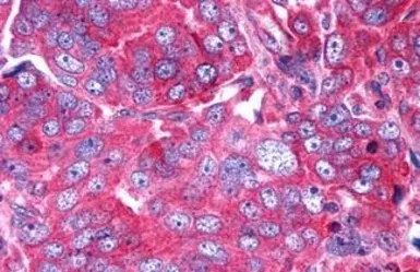 Anti-P2Y6 antibody used in IHC (Paraffin sections) (IHC-P). GTX13391