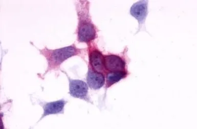 Anti-P2Y6 antibody used in Immunocytochemistry/ Immunofluorescence (ICC/IF). GTX13391