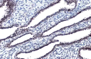 Anti-JNK (phospho Thr183/Tyr185) antibody used in IHC (Paraffin sections) (IHC-P). GTX133934
