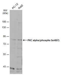 Anti-PKC alpha (phospho Ser657) antibody used in Western Blot (WB). GTX133936