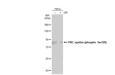 Anti-PKC epsilon (phospho Ser729) antibody used in Western Blot (WB). GTX133937