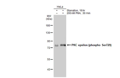 Anti-PKC epsilon (phospho Ser729) antibody used in Western Blot (WB). GTX133937