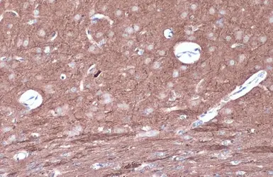 Anti-PKC epsilon (phospho Ser729) antibody used in IHC (Paraffin sections) (IHC-P). GTX133937