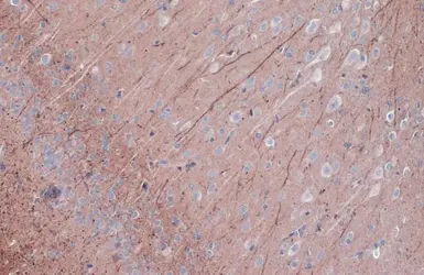 Anti-PKC epsilon (phospho Ser729) antibody used in IHC (Paraffin sections) (IHC-P). GTX133937