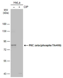 Anti-PKC zeta (phospho Thr410) antibody used in Western Blot (WB). GTX133939