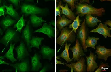 Anti-PKC zeta (phospho Thr410) antibody used in Immunocytochemistry/ Immunofluorescence (ICC/IF). GTX133939