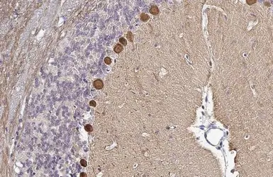 Anti-PKC zeta (phospho Thr410) antibody used in IHC (Paraffin sections) (IHC-P). GTX133939