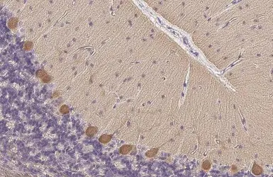 Anti-PKC zeta (phospho Thr410) antibody used in IHC (Paraffin sections) (IHC-P). GTX133939