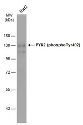 Anti-PYK2 (phospho Tyr402) antibody used in Western Blot (WB). GTX133940