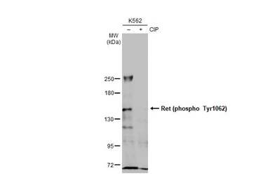 Anti-Ret (phospho Tyr1062) antibody used in Western Blot (WB). GTX133941