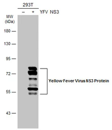Anti-Yellow Fever virus NS3 Protein antibody used in Western Blot (WB). GTX133958