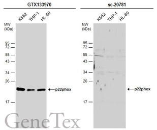Anti-p22phox antibody used in Western Blot (WB). GTX133970