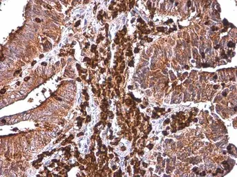 Anti-p22phox antibody used in IHC (Paraffin sections) (IHC-P). GTX133970