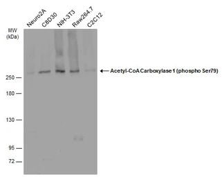 Anti-Acetyl-CoA Carboxylase 1 (phospho Ser79) antibody used in Western Blot (WB). GTX133974