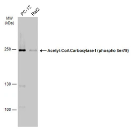 Anti-Acetyl-CoA Carboxylase 1 (phospho Ser79) antibody used in Western Blot (WB). GTX133974