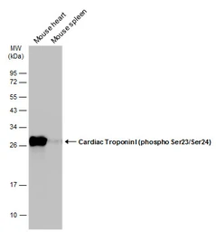 Anti-Cardiac Troponin I (phospho Ser23/Ser24) antibody used in Western Blot (WB). GTX133976