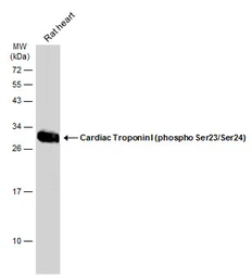 Anti-Cardiac Troponin I (phospho Ser23/Ser24) antibody used in Western Blot (WB). GTX133976