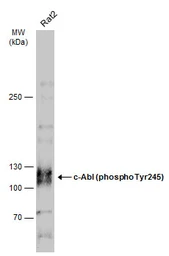 Anti-c-Abl (phospho Tyr245) antibody used in Western Blot (WB). GTX133980
