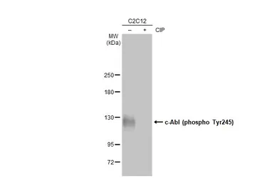 Anti-c-Abl (phospho Tyr245) antibody used in Western Blot (WB). GTX133980