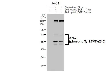 Anti-SHC1 (phospho Tyr239/240) antibody used in Western Blot (WB). GTX133985