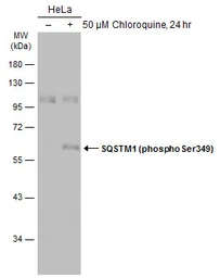 Anti-SQSTM1 / P62 (phospho Ser349) antibody used in Western Blot (WB). GTX134001