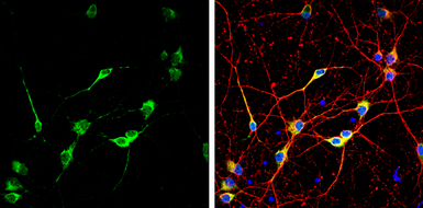 Anti-CGRP antibody used in Immunocytochemistry/ Immunofluorescence (ICC/IF). GTX134005